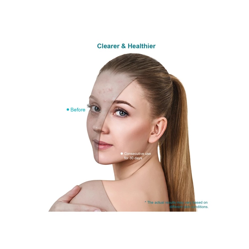 Xpreen Light Therapy Acne Treatment Face Mask